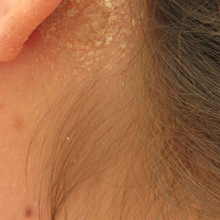 Impacto Emocional: Como Lidar com a Autoestima e o Desconforto - inspiração 2