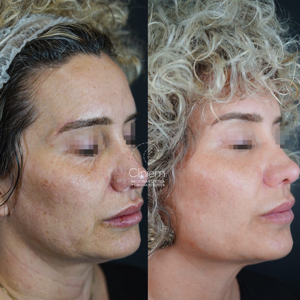 Entendendo as Manchas: Por Que Elas Aparecem e Quais Tipos Existem? - inspiração 1