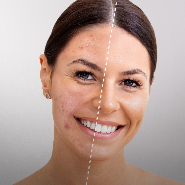 O Laser Como Solução: Como Essa Tecnologia Funciona na Pele? - inspiração 1