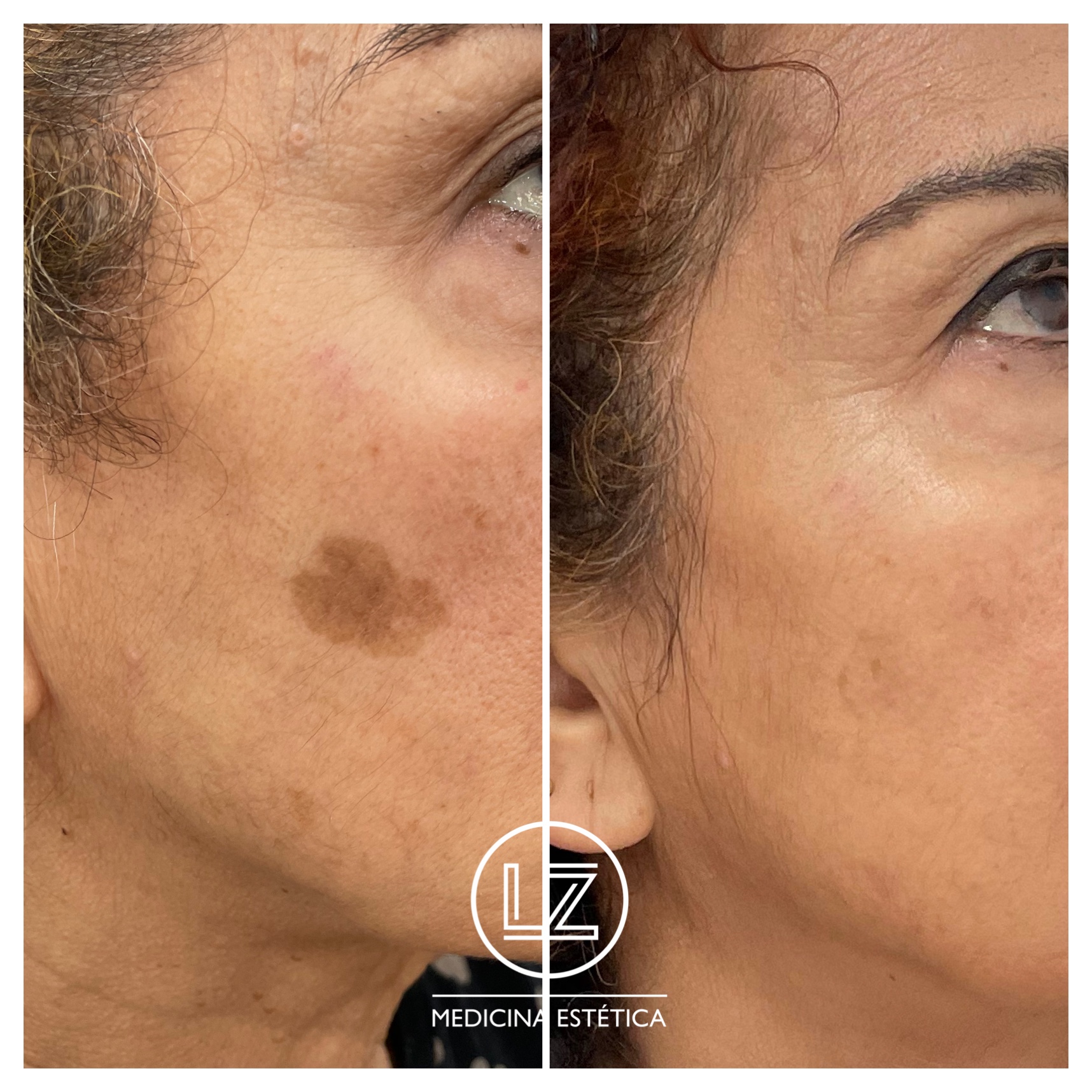 Preparação Essencial: O Que Fazer Antes do Procedimento? - inspiração 2