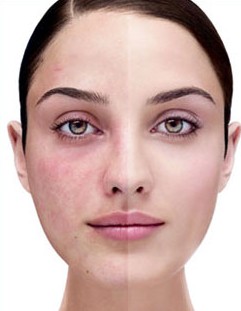 Técnicas de Aplicação: Leveza e Precisão para Evitar Irritação - inspiração 2