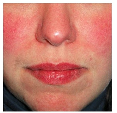 Selação Estratégica: Finalizando a Maquiagem sem Obstruir Poros - inspiração 1