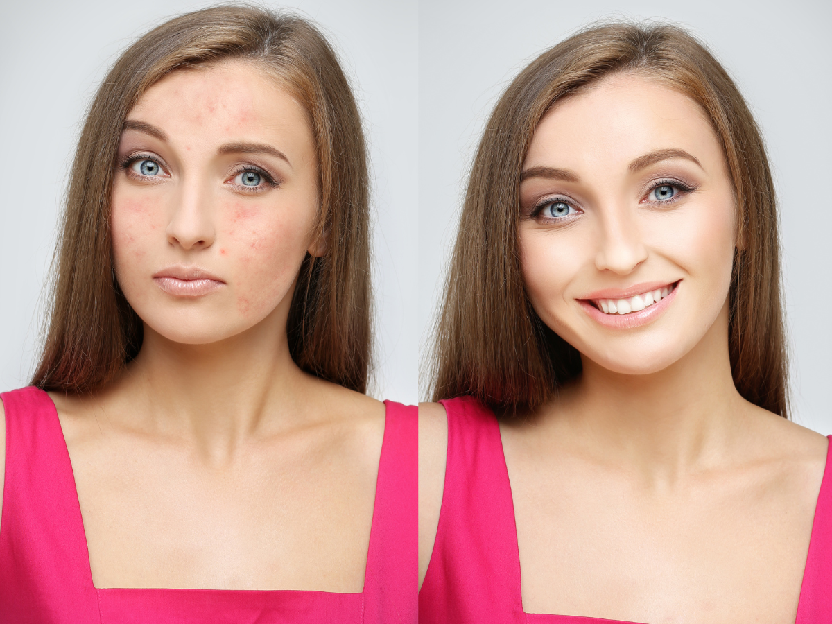 Cuidados Pós-Maquiagem: Limpeza Suave para Pele Tranquila - inspiração 2