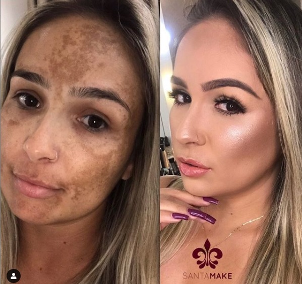 Protetor Solar com Cor: Seu Aliado Diário Contra o Melasma - inspiração 2