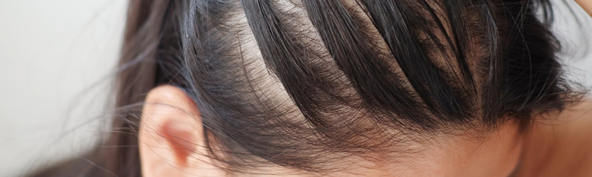 Entendendo a Produção de Sebo: A Ciência por Trás da Oleosidade - inspiração 2