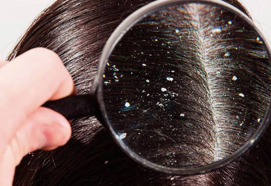 Evitando Armadilhas Comuns: Produtos que Pioram a Situação - inspiração 2