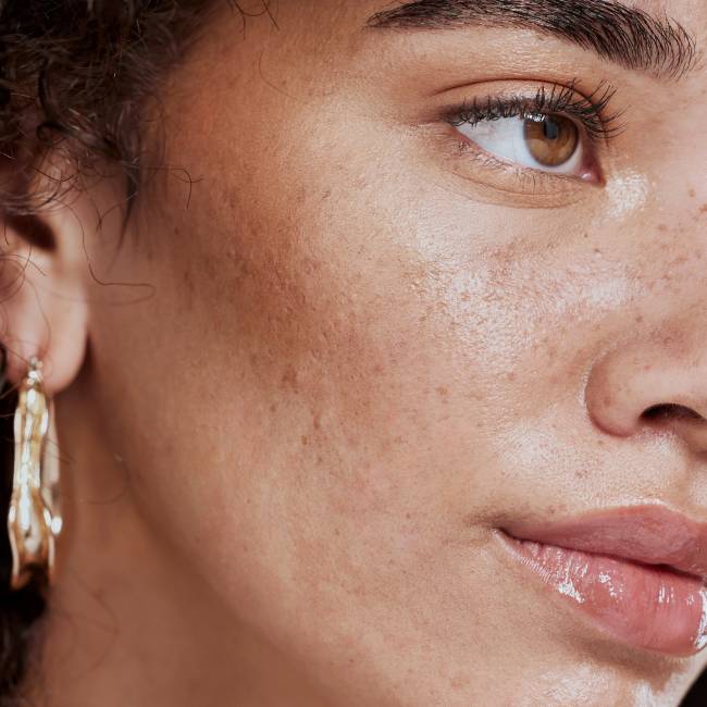 Hidratação Leve: O Equilíbrio é a Chave - inspiração 1