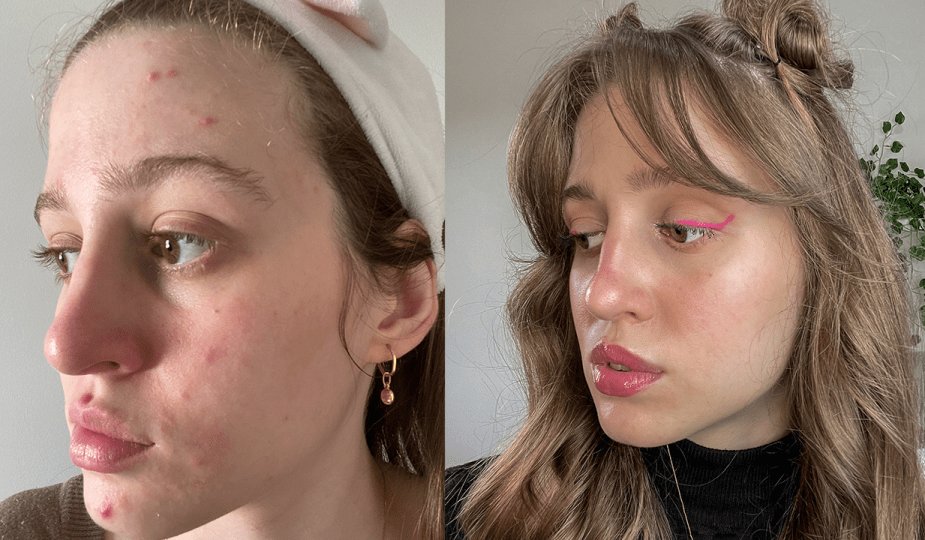 Paciência e Consistência: A Dupla Imbatível - inspiração 2