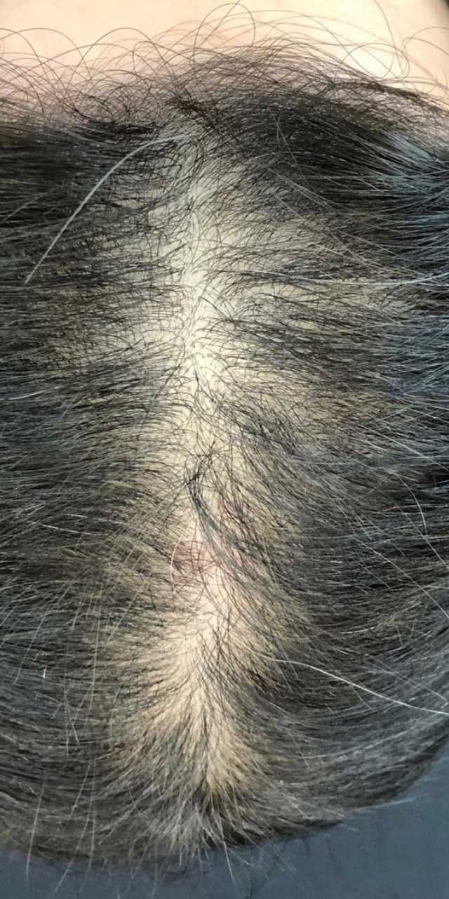 Paciência e Autocuidado: Recuperação Capilar em Foco - inspiração 1