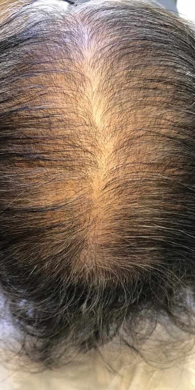 Nutrição Poderosa: Os Nutrientes Que Seu Cabelo Pede Agora - inspiração 2