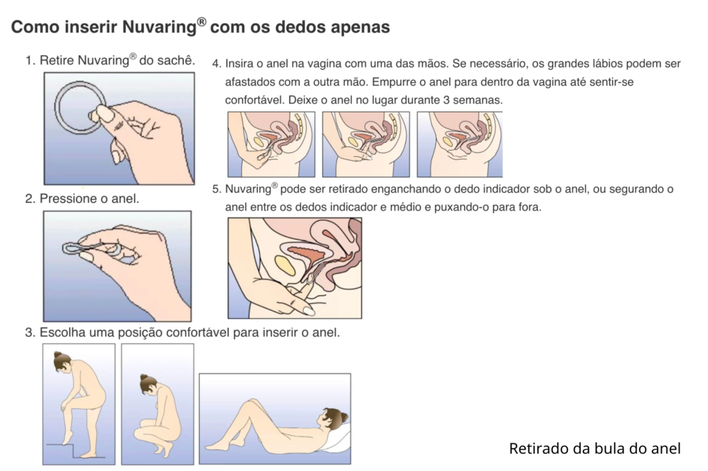 anel vaginal preço