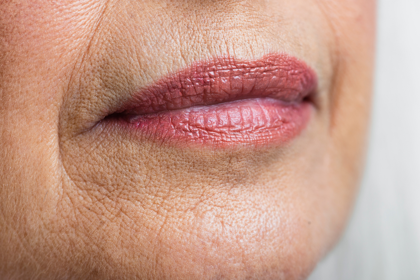 Mitos e Verdades sobre a Durabilidade do Preenchimento Labial com Ácido Hialurônico