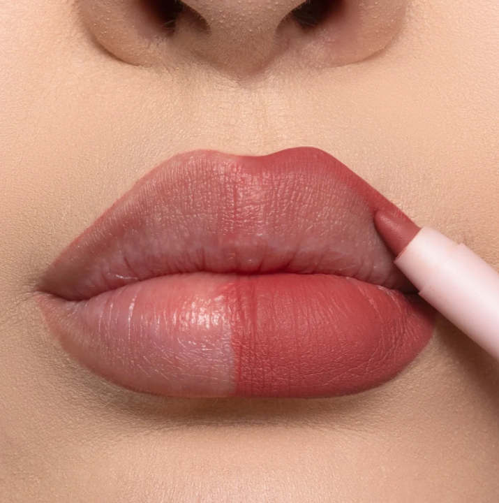 Mitos e Verdades sobre a Durabilidade do Preenchimento Labial com Ácido Hialurônico