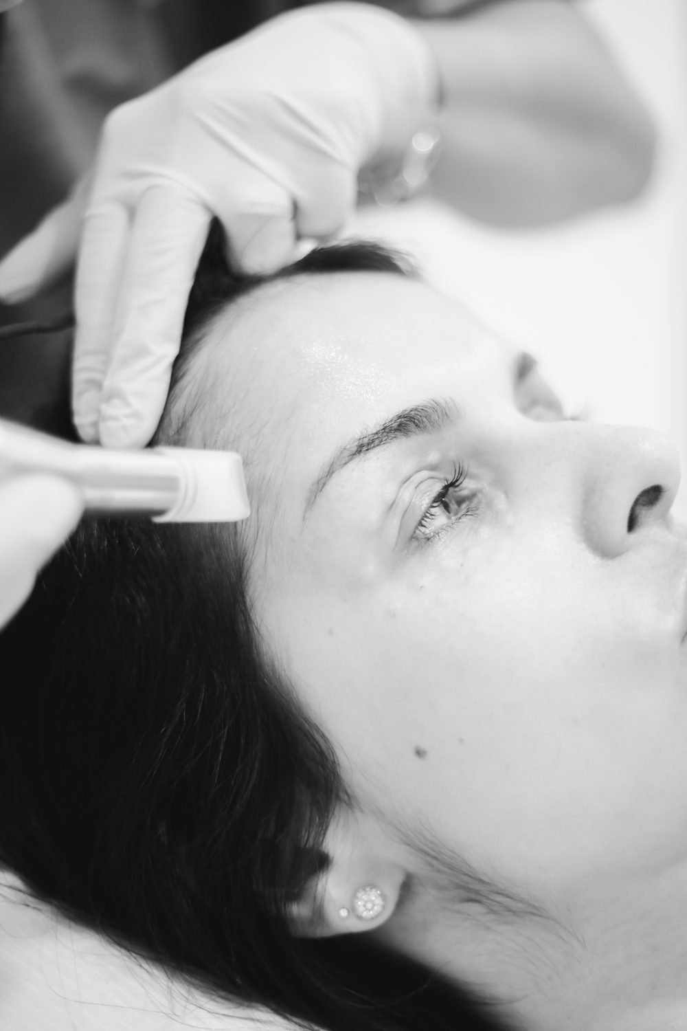 Fatores que Influenciam a Sensação de Dor na Depilação a Laser