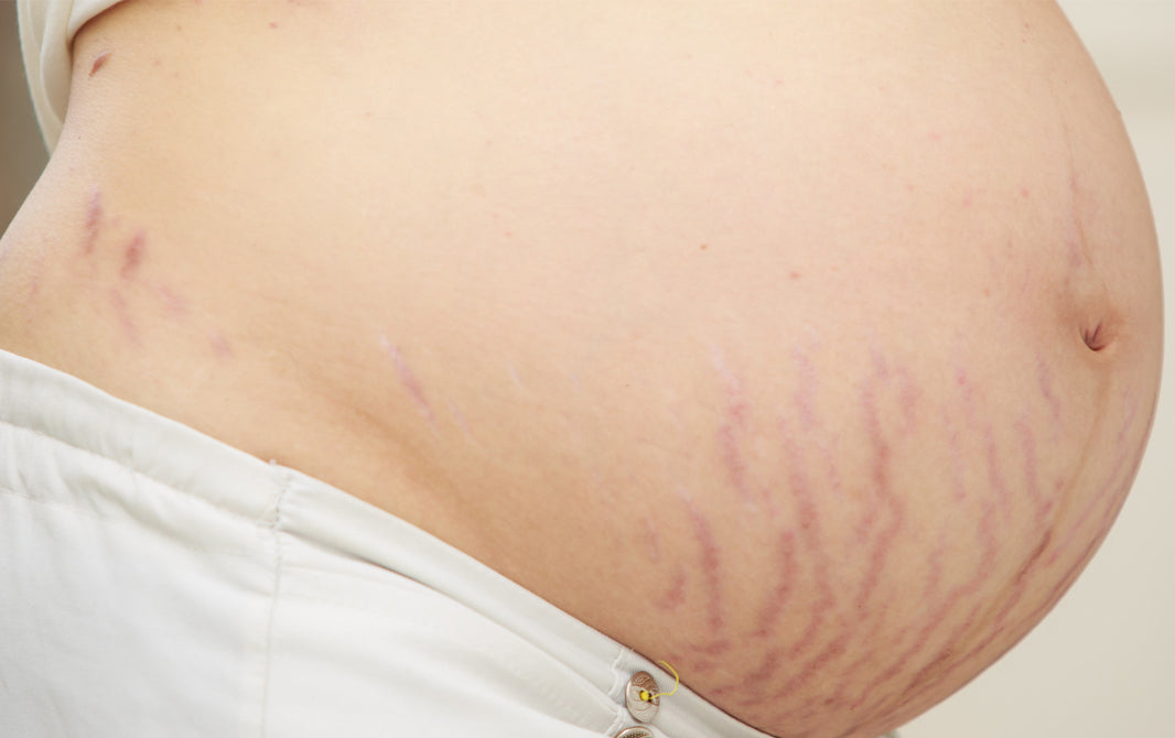 Rotina de Skincare para Gestantes: Produtos Seguros e Dicas Essenciais