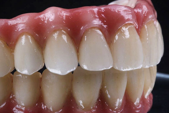 Implante dentário carga imediata valor médio 2026