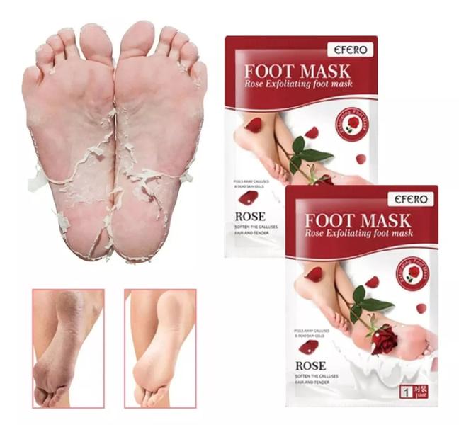 5 ideias de títulos:
1. Meia Esfoliante: Guia Completo de Como Usar e Cuidados Essenciais
2. Descubra o Poder da Meia Esfoliante para Pés Lisos e Macios
3. Meia Esfoliante: Funciona Mesmo? Tudo o Que Você Precisa Saber
4. Os Benefícios e Riscos da Meia Esfoliante para os Pés
5. Como Obter Pés de Bebê com a Meia Esfoliante: Passo a Passo