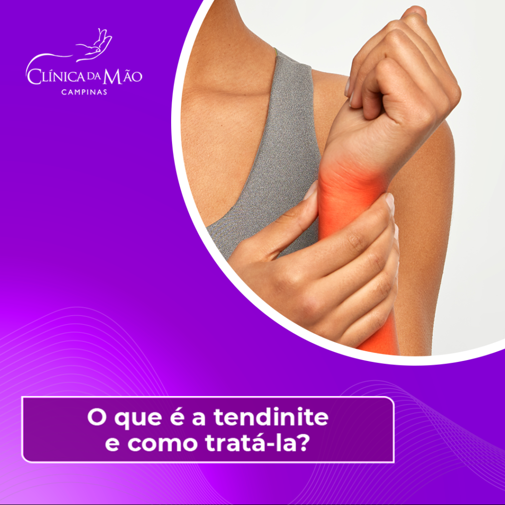 o que e tendinite