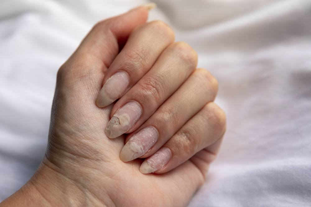 7 dicas para ter unhas fortes e saudáveis naturalmente