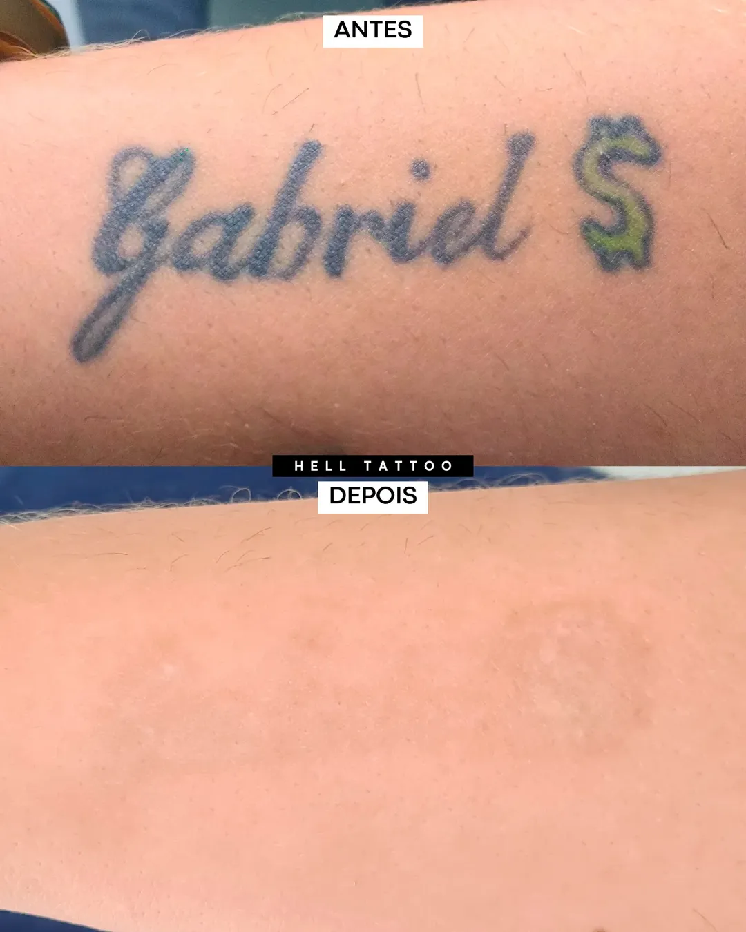 tatuagem intensa vs tatuagem de símbolo