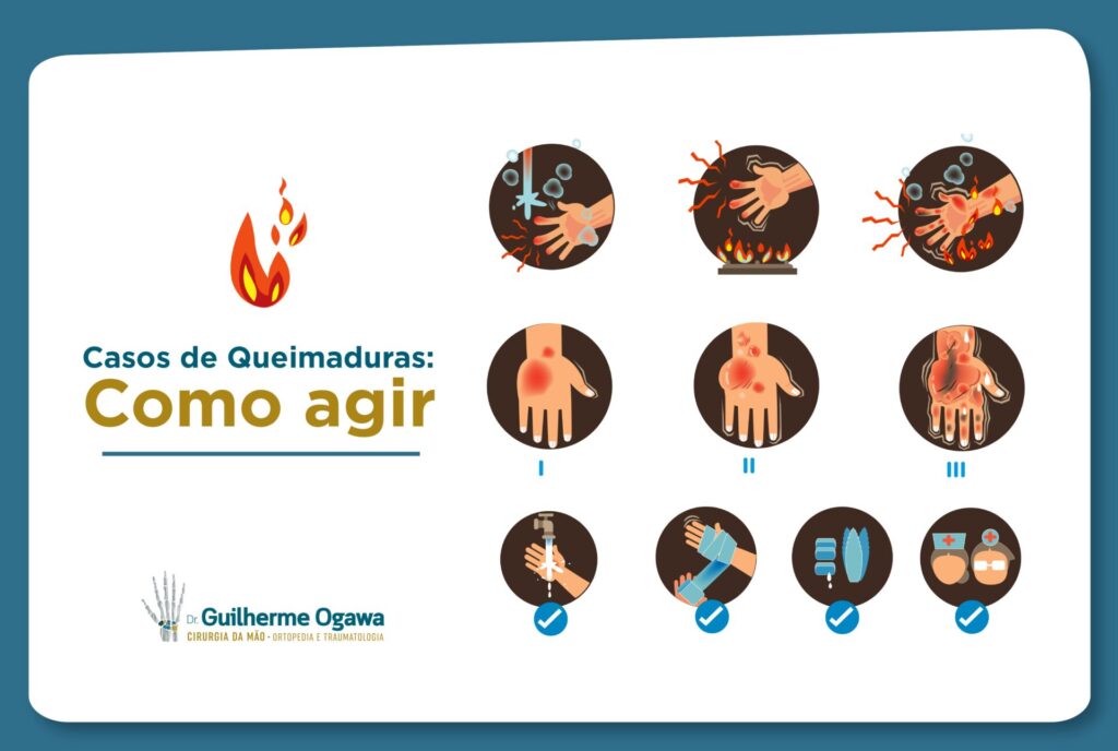 Tratar Queimaduras